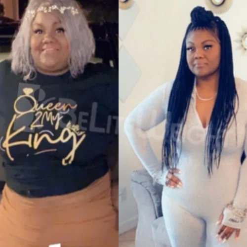 Naike E - 12 Month Update*